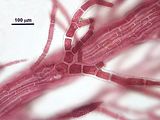 3 – Dettaglio di una pseudolaterale e della corticazione nel terzo superiore di un asse